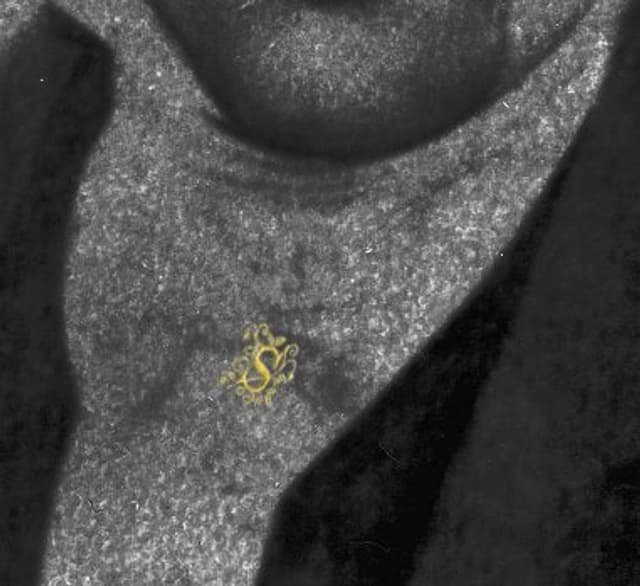 8. Case of the missing button and much more... (image 2)