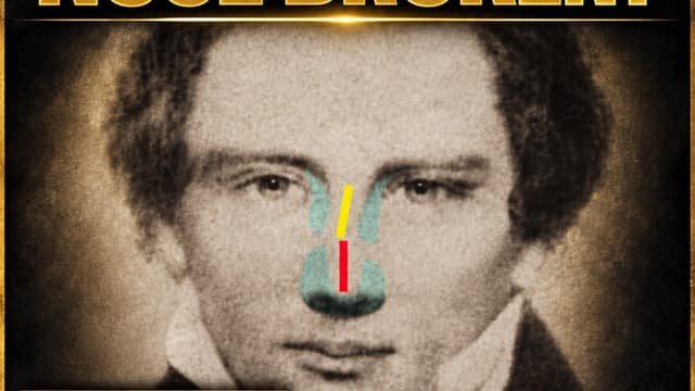 Did Joseph have a broken nose? Watch the video to find out. (image 1)