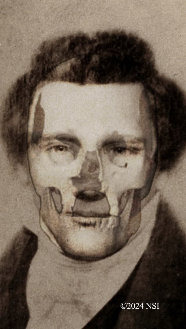 Does the Unedited Photo of Joseph Smith Match the Skull (image 3)