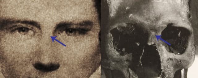A Photographic Comparison of Joseph's Injuries (image 1)