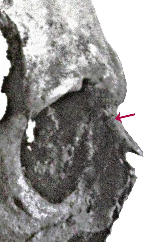A Photographic Comparison of Joseph's Injuries (image 2)