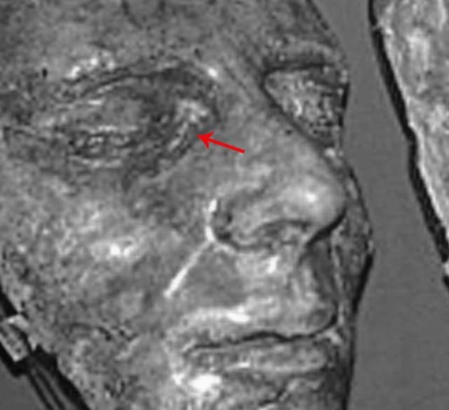 A Photographic Comparison of Joseph's Injuries (image 3)